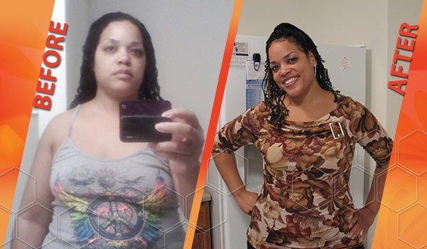HCG diet before and after picture
